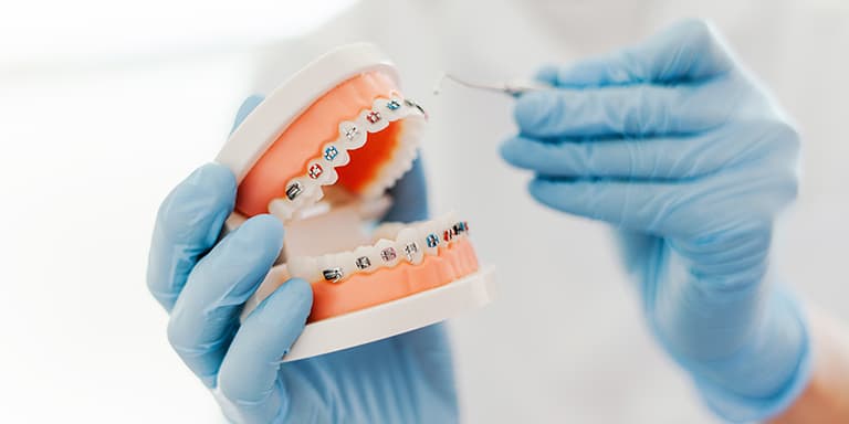Escolher o melhor seguro dentário para aparelho permite-lhe poupar e beneficiar de melhores cuidados. Saiba o que ter em cont