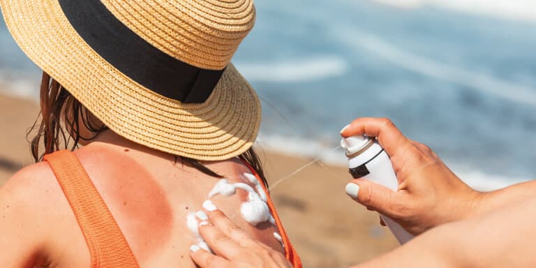 Descubra como curar um escaldão solar rapidamente e quais os cuidados a ter para prevenir novas queimaduras solares.